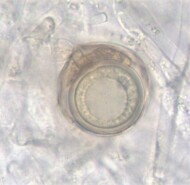 Organizm grzybopodobny Globisporangium ultimum, znany bardziej pod dawną nazwą Pythium ultimum - widok spod mikroskopu (fot. S. Stępniewska-Jarosz)