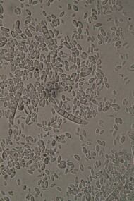 Zarodniki Fusarium solani (fot. Sylwia Stępniewska-Jarosz)